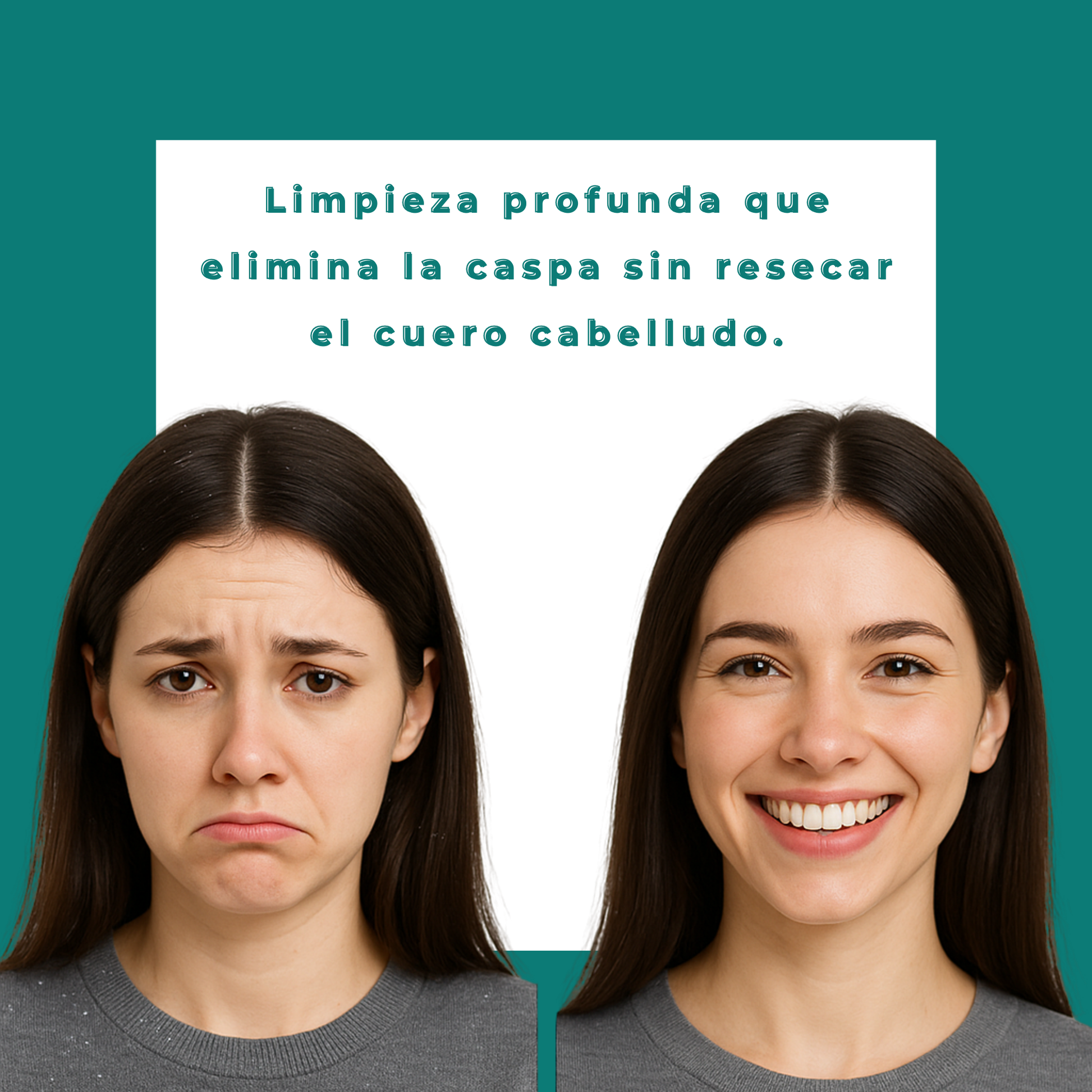 Shampoo Crematizado Anticaspa | 260ml